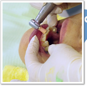 予防歯科・歯周病治療　イメージ02
